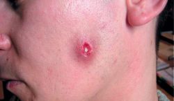 Заменитель Базирона по составу Заменитель Базирона по составу