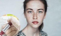 Салицилово-цинковая паста против прыщей Салицилово-цинковая паста против прыщей