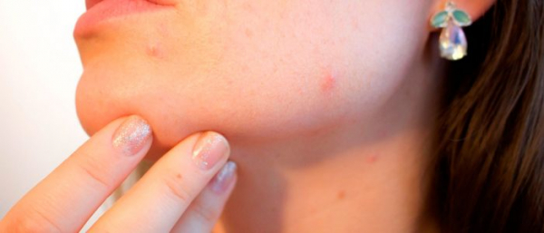 Бородавка кровит