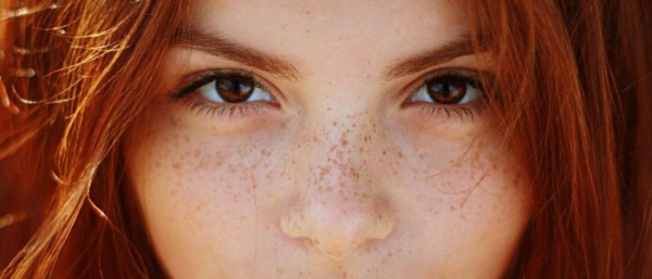 Как справиться с пигментными пятнами на лице?