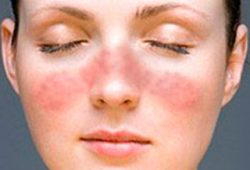 Заменитель Базирона по составу Заменитель Базирона по составу