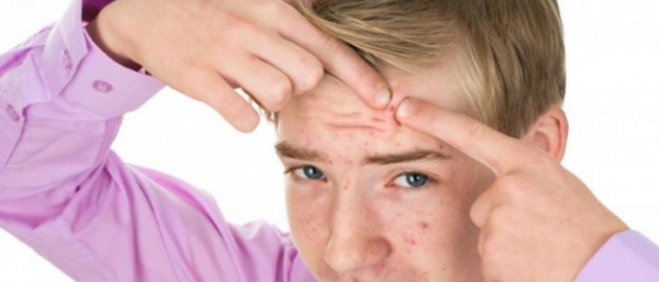 Средства от прыщей для подростков