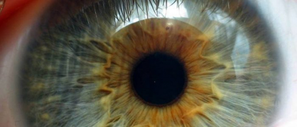 Пигментная дистрофия сетчатки