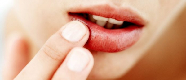 Бородавки на губах