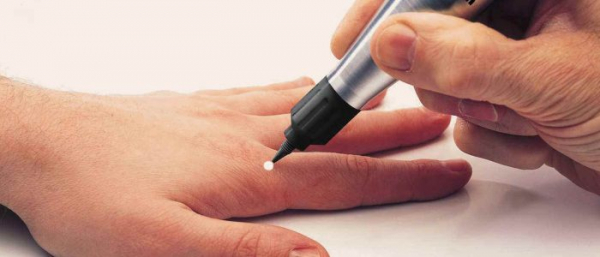 Вульгарная бородавка