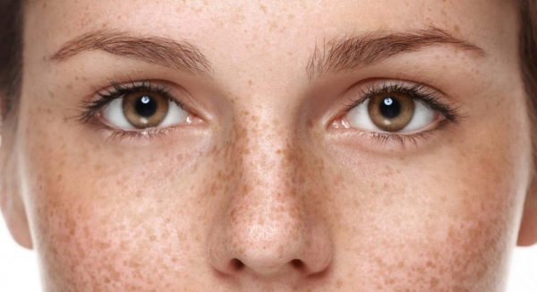 Гормональный сбой и пигментные пятна Гормональный сбой и пигментные пятна