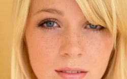 Пигментное пятно на лице после беременности Пигментное пятно на лице после беременности